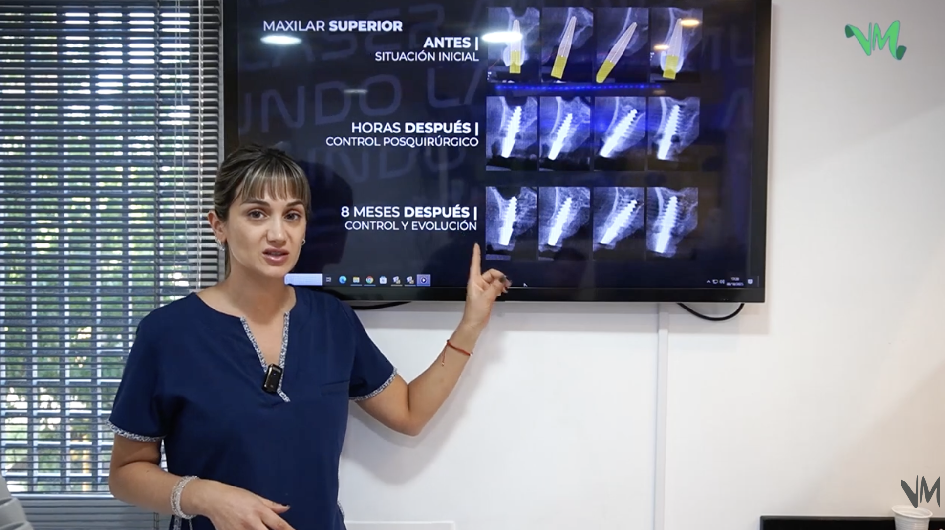 ODONTOLOGÍA: REHABILITACIÓN CON IMPLANTES