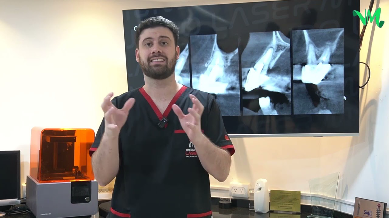 ODONTOLOGÍA: MÁS HUESO, MEJOR IMPLANTE